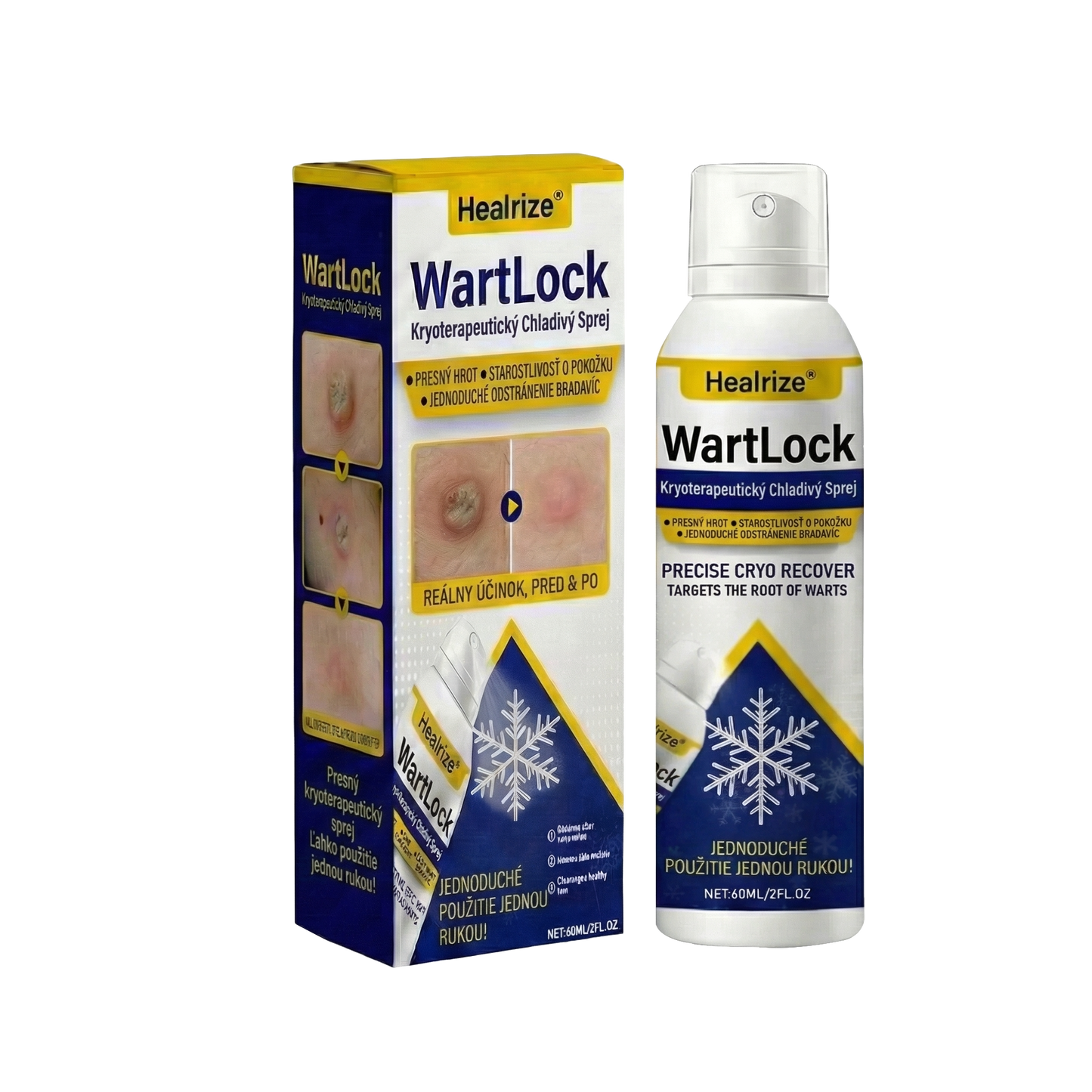 𝑺𝒄𝒉𝒗á𝒍𝒆𝒏é 𝒂𝒈𝒆𝒏𝒕ú𝒓𝒐𝒖 𝑻𝑮𝑨 🚀 | Healrize® WartLock Kryoterapeutický Chladivý Sprej 🚀