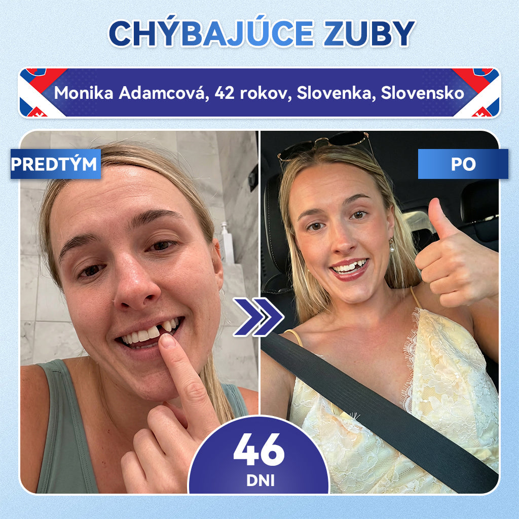 🦷𝐆𝐥𝐢𝐦𝐦𝐞𝐫𝐥𝐲® Tideglusib zuby a dasna Opravná náplasť s mikroihlami  | Pokročilé zubné pásiky s aktiváciou kmeňových buniek (obnova skloviny a dentínu • posilnenie ďasien • odstránenie zubného kameňa a zápachu • zastavenie citlivosti zubov)) 3.0