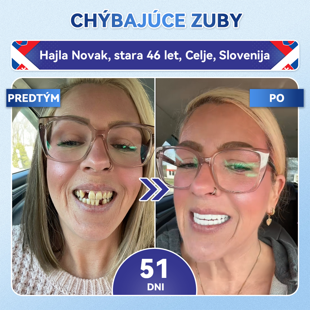 🦷𝐆𝐥𝐢𝐦𝐦𝐞𝐫𝐥𝐲® Tideglusib zuby a dasna Opravná náplasť s mikroihlami  | Pokročilé zubné pásiky s aktiváciou kmeňových buniek (obnova skloviny a dentínu • posilnenie ďasien • odstránenie zubného kameňa a zápachu • zastavenie citlivosti zubov)) 3.0