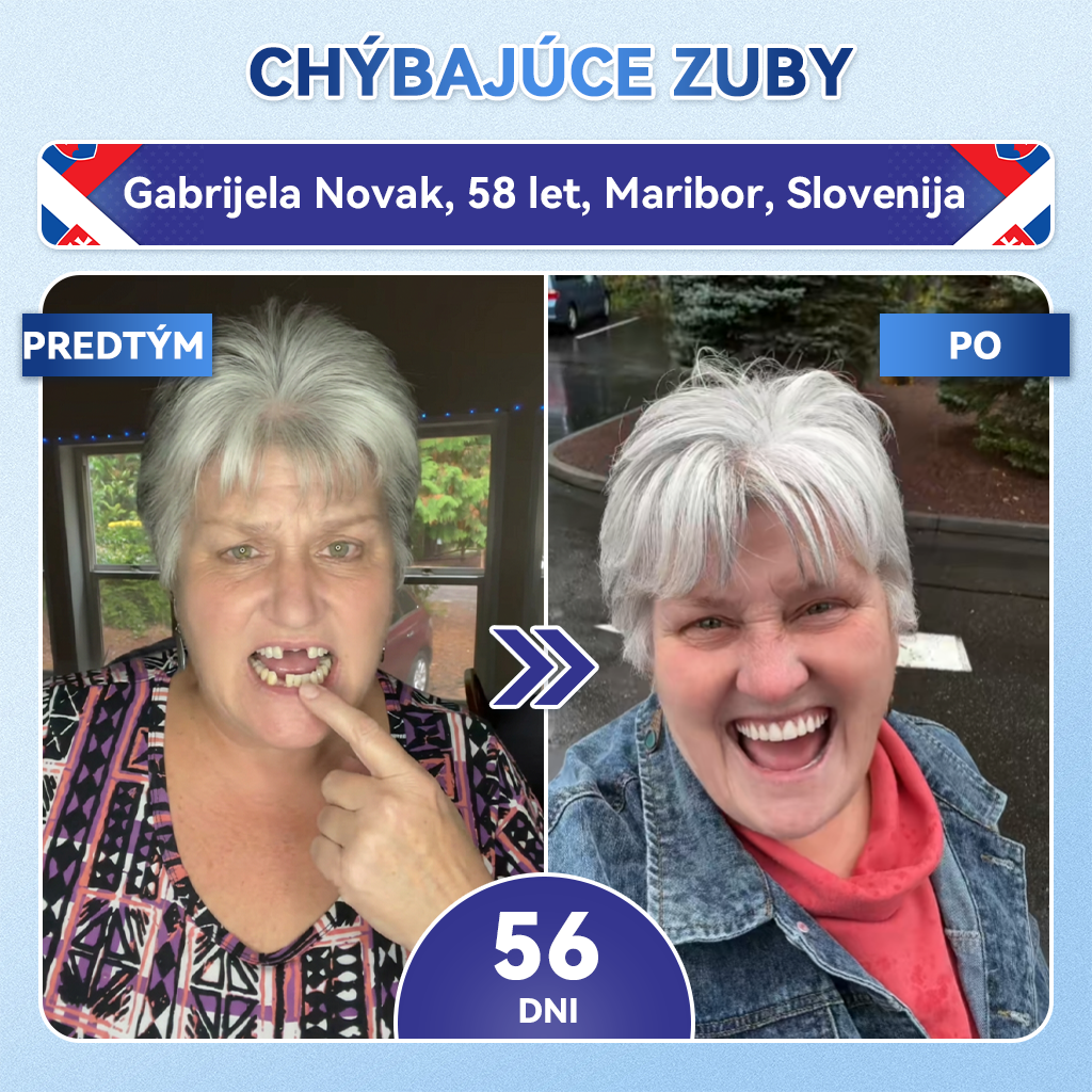 🦷𝐆𝐥𝐢𝐦𝐦𝐞𝐫𝐥𝐲® Tideglusib zuby a dasna Opravná náplasť s mikroihlami  | Pokročilé zubné pásiky s aktiváciou kmeňových buniek (obnova skloviny a dentínu • posilnenie ďasien • odstránenie zubného kameňa a zápachu • zastavenie citlivosti zubov)) 3.0