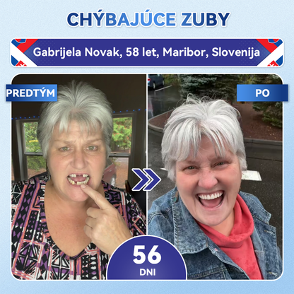 🦷𝐆𝐥𝐢𝐦𝐦𝐞𝐫𝐥𝐲® Tideglusib zuby a dasna Opravná náplasť s mikroihlami  | Pokročilé zubné pásiky s aktiváciou kmeňových buniek (obnova skloviny a dentínu • posilnenie ďasien • odstránenie zubného kameňa a zápachu • zastavenie citlivosti zubov)) 3.0