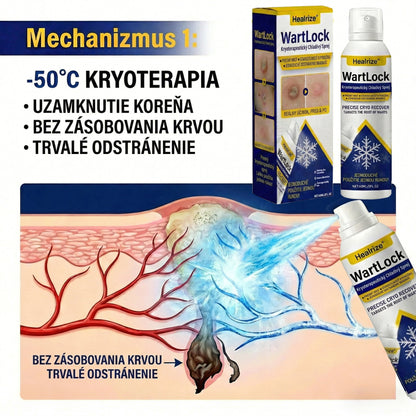 𝑺𝒄𝒉𝒗á𝒍𝒆𝒏é 𝒂𝒈𝒆𝒏𝒕ú𝒓𝒐𝒖 𝑻𝑮𝑨 🚀 | Healrize® WartLock Kryoterapeutický Chladivý Sprej 🚀