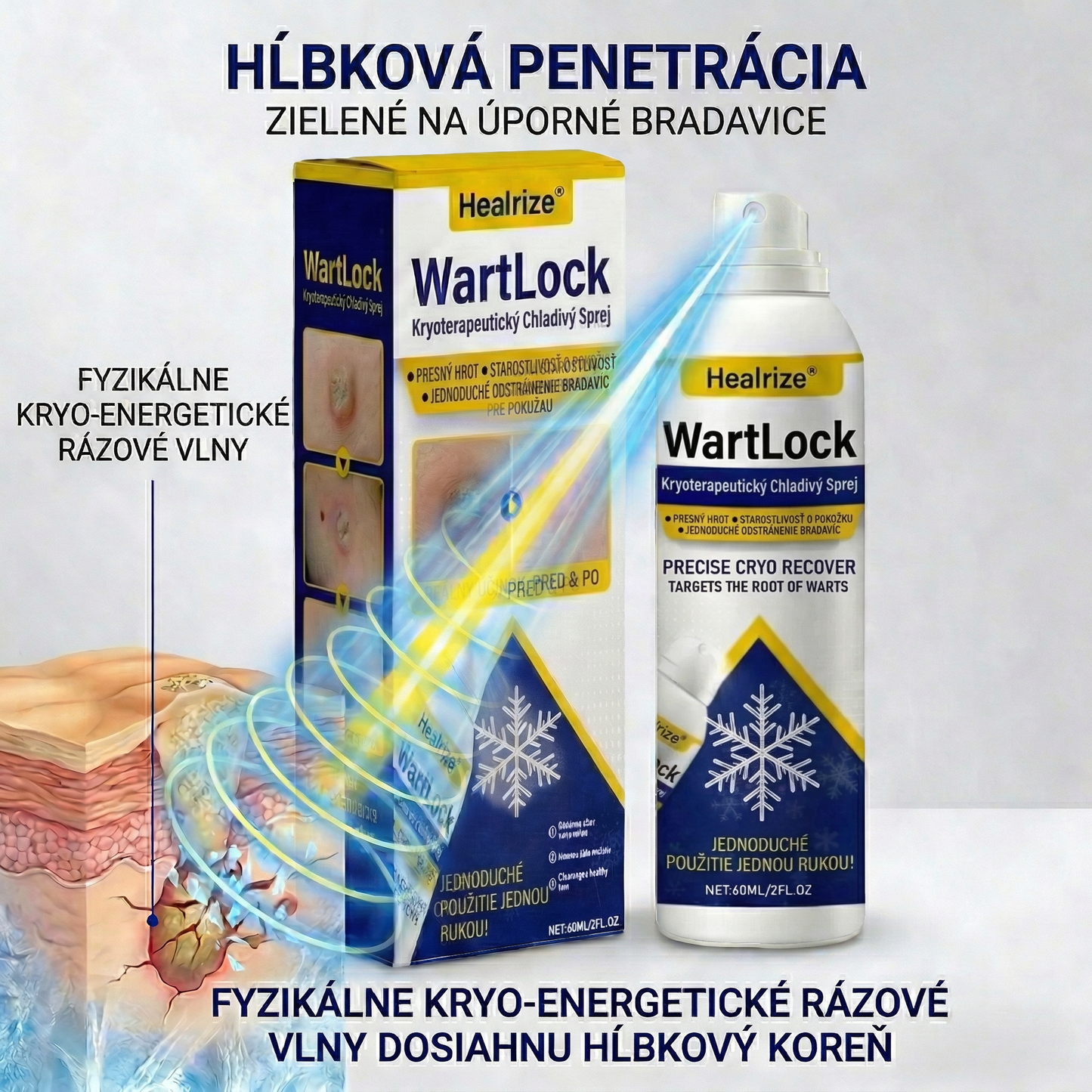 𝑺𝒄𝒉𝒗á𝒍𝒆𝒏é 𝒂𝒈𝒆𝒏𝒕ú𝒓𝒐𝒖 𝑻𝑮𝑨 🚀 | Healrize® WartLock Kryoterapeutický Chladivý Sprej 🚀