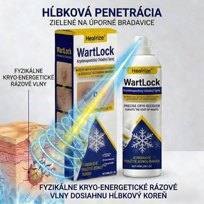 𝑺𝒄𝒉𝒗á𝒍𝒆𝒏é 𝒂𝒈𝒆𝒏𝒕ú𝒓𝒐𝒖 𝑻𝑮𝑨 🚀 | Healrize® WartLock Kryoterapeutický Chladivý Sprej 🚀