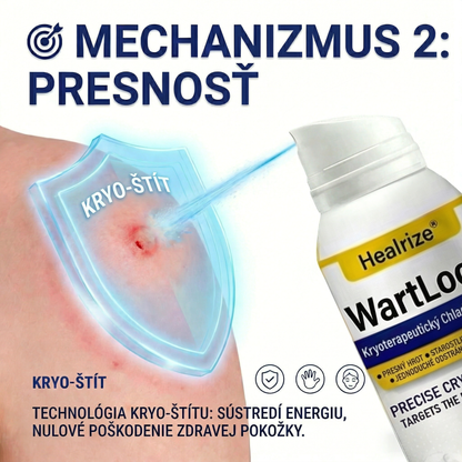 𝑺𝒄𝒉𝒗á𝒍𝒆𝒏é 𝒂𝒈𝒆𝒏𝒕ú𝒓𝒐𝒖 𝑻𝑮𝑨 🚀 | Healrize® WartLock Kryoterapeutický Chladivý Sprej 🚀